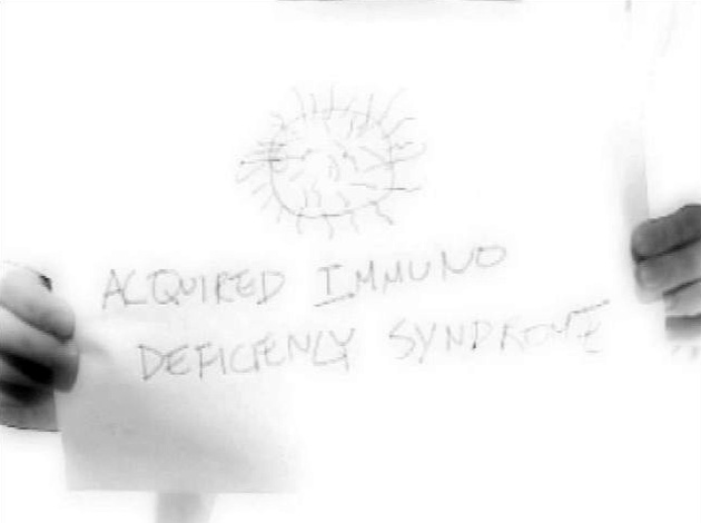 Acquired Immuno Deficiency Syndrome